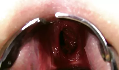 Amateur Fick treffen pornobilder in hd